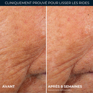 Serum capsules soin lissant rétinol pour rides