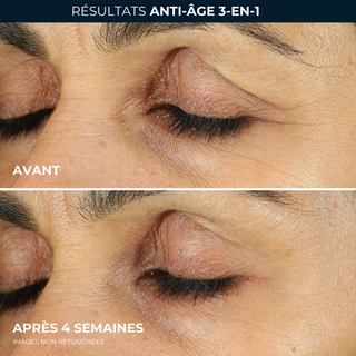 Crème contour yeux soin lissant rétinol pour rides