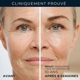 Crème contour yeux soin lissant rétinol pour rides