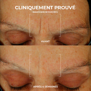 Retinol Correxion Soin Lissant Hydratation Maximale