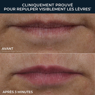 DERM CORREXION® Lip Volumizer