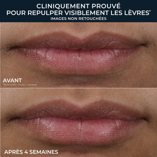 DERM CORREXION® Lip Volumizer