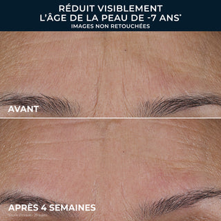 RETINOL CORREXION® Soin Lissant Triple Sérum