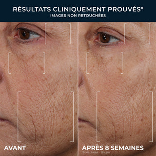 RETINOL CORREXION® Soin Lissant Triple Sérum