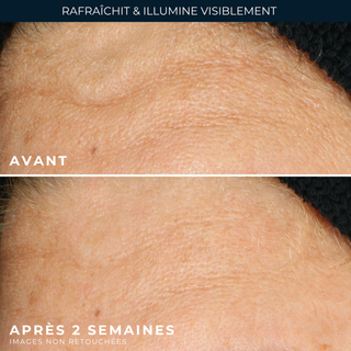 Gel nettoyant Renouveau + Eclat 