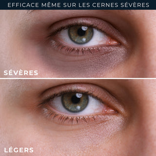 DERM CORREXION SOINS CIBLÉS Eye Repair