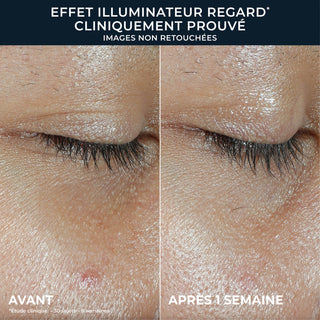 MULTI CORREXION® Renouveau + Éclat Baume pour les yeux