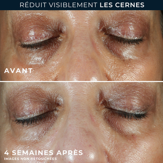 Contour yeux Unifier + Lifter 